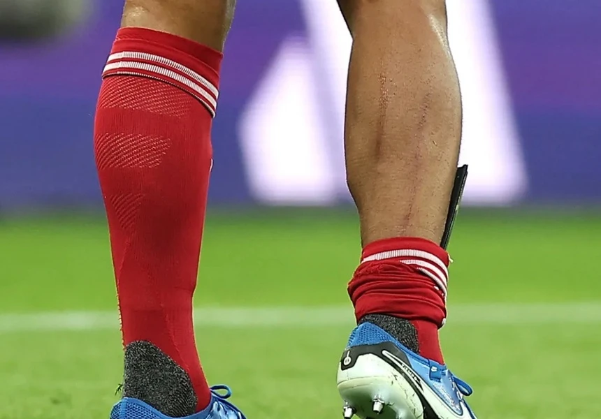 Van Dijk anh 1